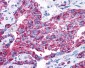 VPAC2 / VIPR2 Antibody (C-Terminus)